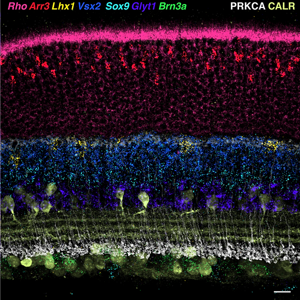 Spatial transcriptomics
